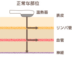 スーパー温熱