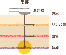 スーパー温熱